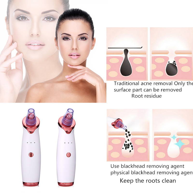Electric Blackhead Remover