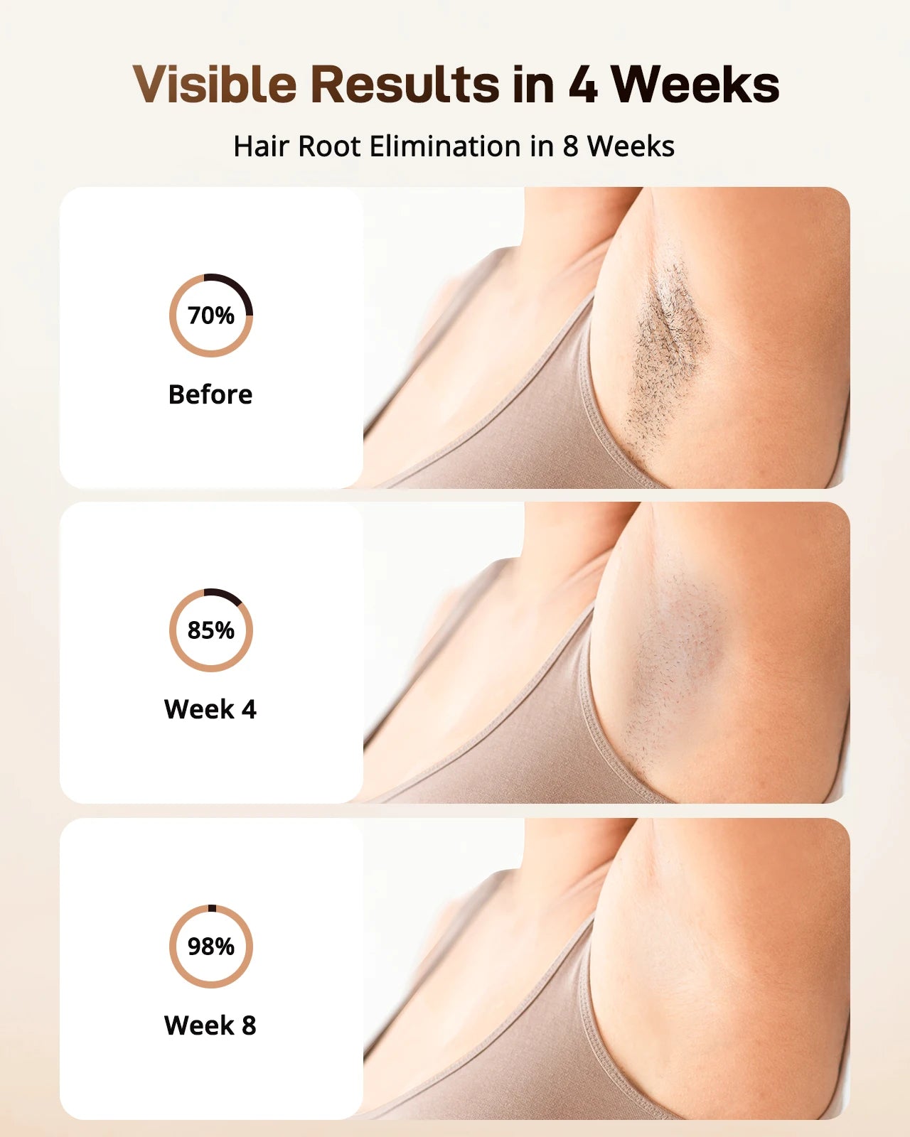 3-in-1 IPL Laser Hair Removal Device with Ice Cooling