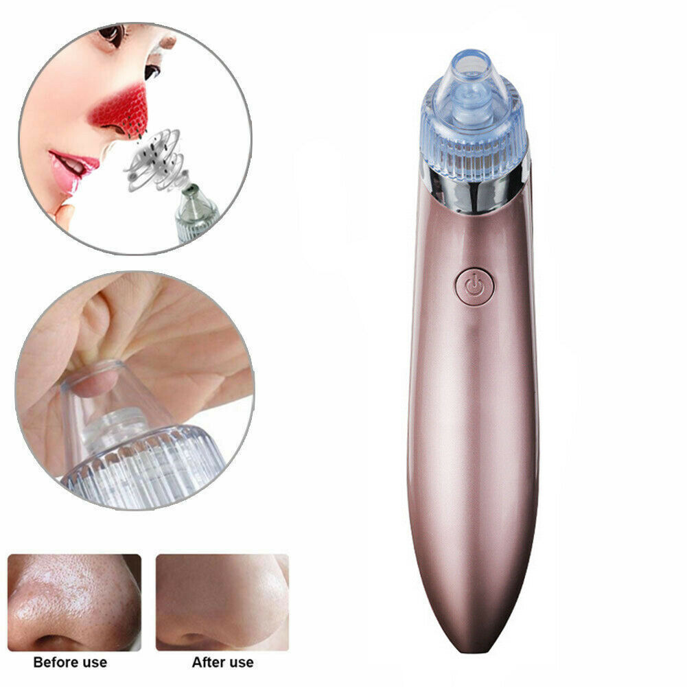 Electric Blackhead Remover - Beauty Touch Essentials