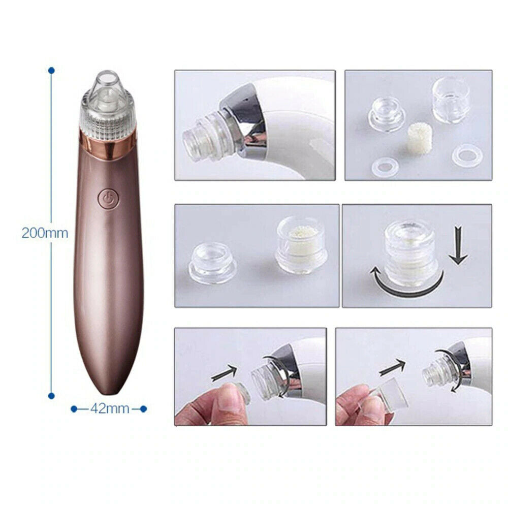 Electric Blackhead Remover - Beauty Touch Essentials