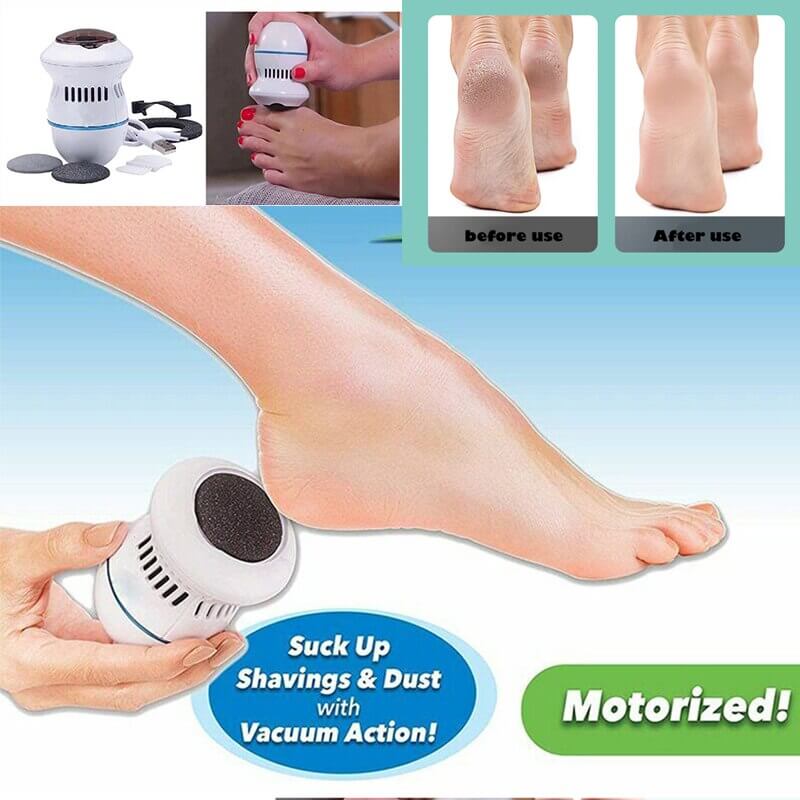 Electric Vacuum Foot Grinder - before and after