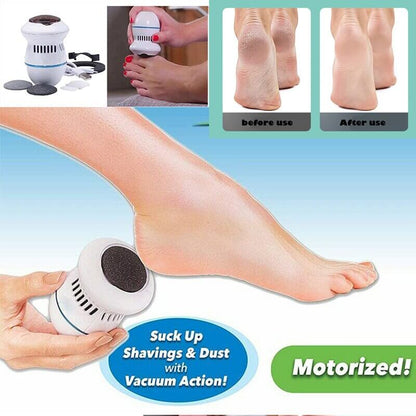 Electric Vacuum Foot Grinder - before and after