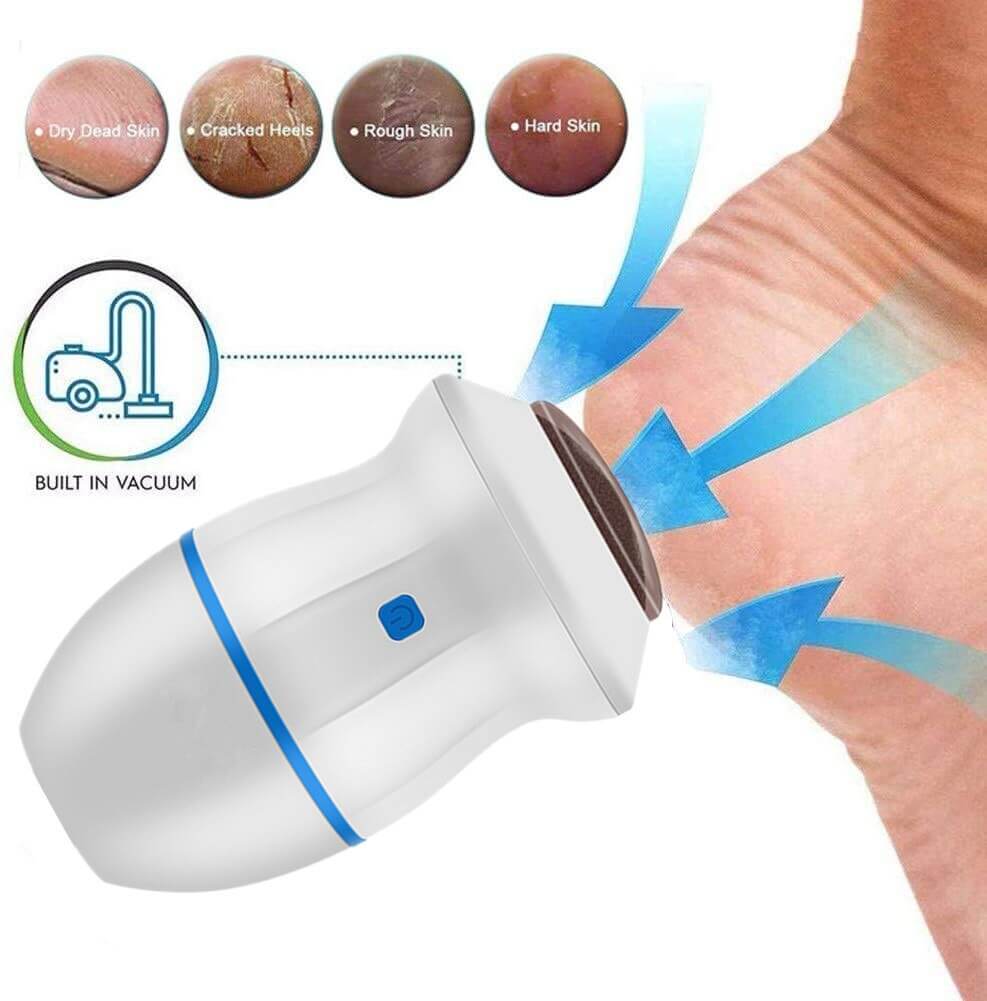Electric Vacuum Foot Grinder with examples of damaged heels