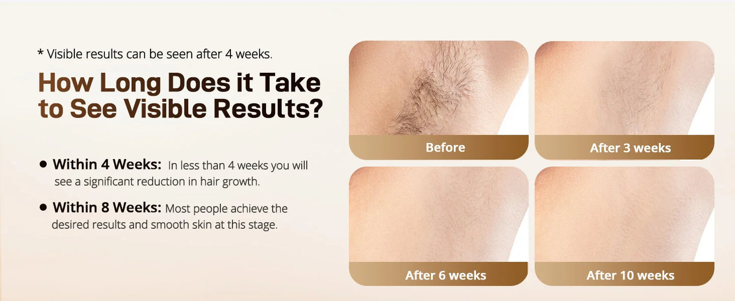 3-in-1 IPL Laser Hair Removal Device with Ice Cooling