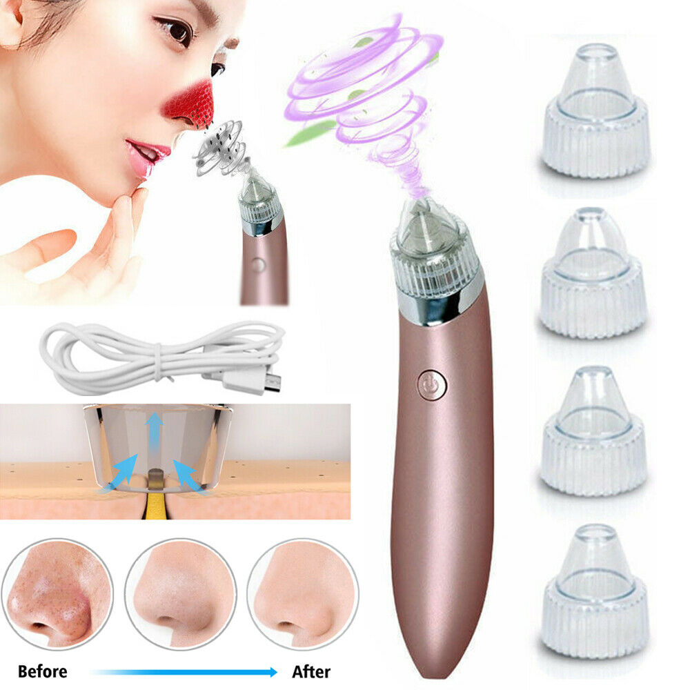 Electric Blackhead Remover - Beauty Touch Essentials