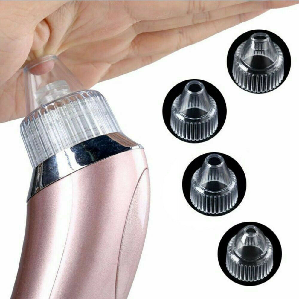 Electric Blackhead Remover - Beauty Touch Essentials