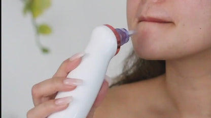 Electric Blackhead Remover